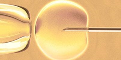 Fertilização in vitro com ICSI