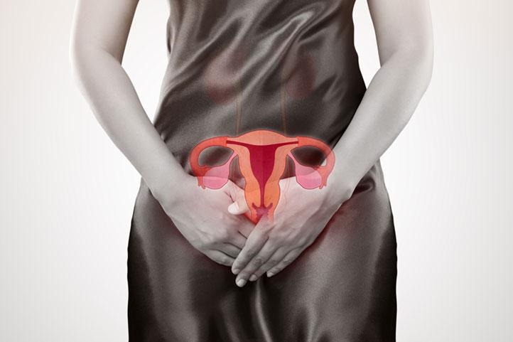 Infertilidade Conjugal e Endometriose