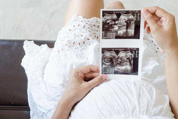 Ovodoação: transparência e facilidade no tratamento