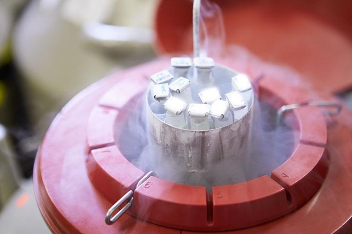 Preservação da Fertilidade: Criopreservação de Tecido Ovariano